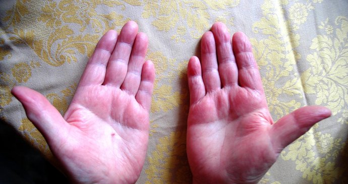 Dlaně Jarmily Novákové jsou jemné, ale na bříšcích prstů nejsou vidět miniaturní kožní záhyby, které má každý člověk jedinečné