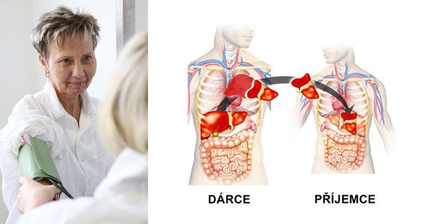 Unikátní operace zachránila pacientce život.