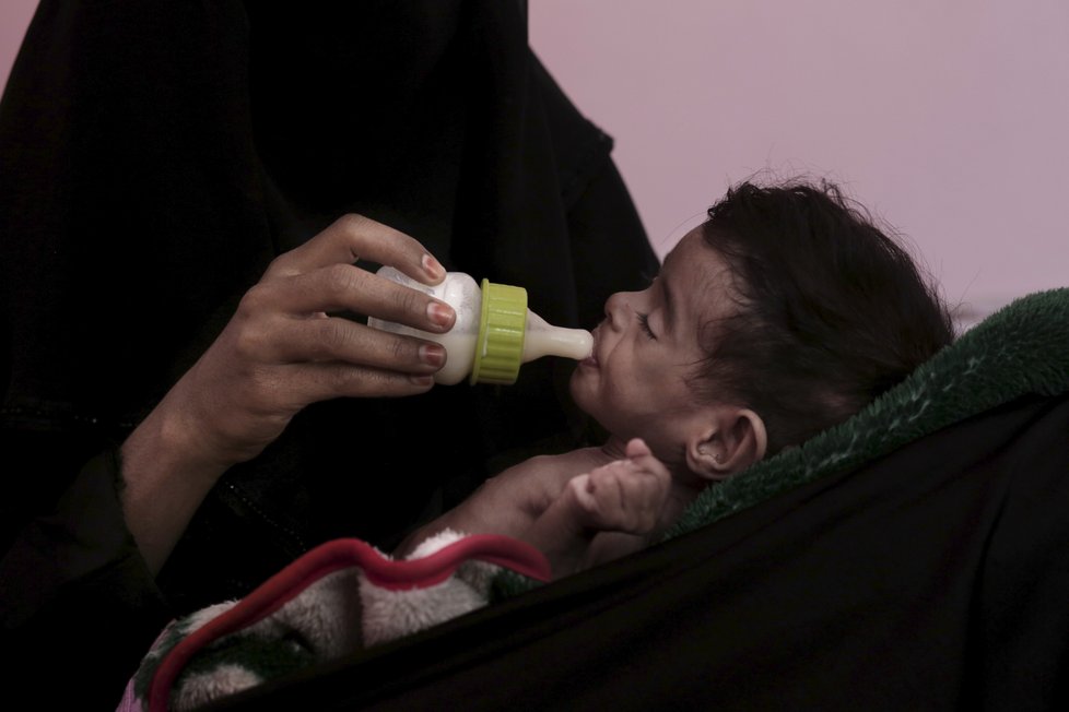 Hladomorem v Jemenu trpí nejvíce děti.
