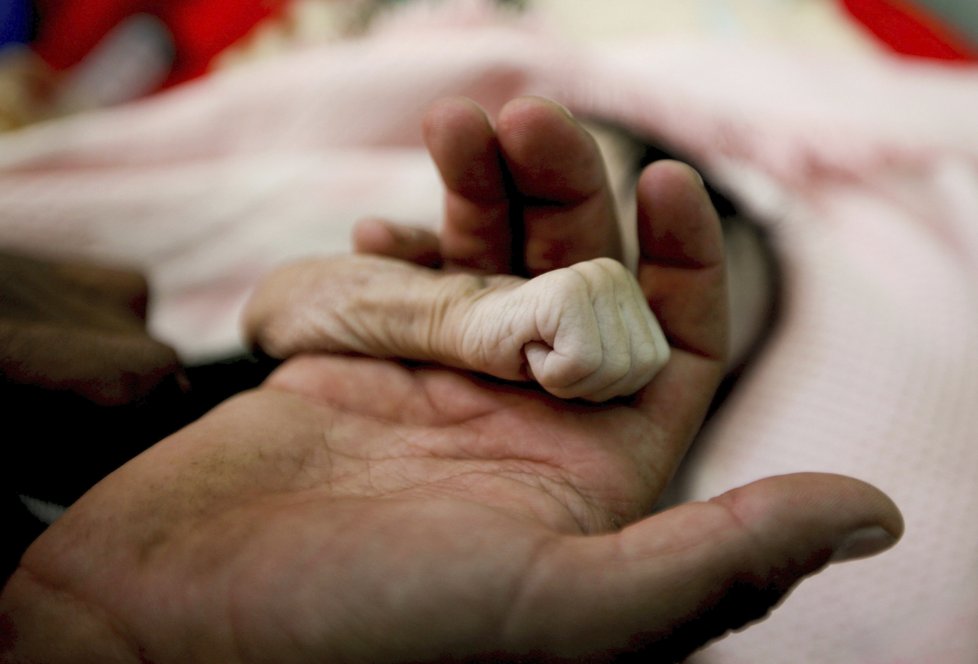 Čtyřměsíční holčička zemřela na podvýživu, její případ není v Jemenu ojedinělý.