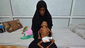 Většina darů UNICEF půjde do nejpostiženějších oblastí, jako hladomorem zasaženého Jemenu.