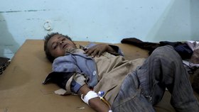 Nálet v provincii Saada si vyžádal přes 50 obětí, většina jsou děti.