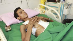 Letecký útok v Jemenu si vyžádal řadu obětí, jsou mezi nimi i děti.