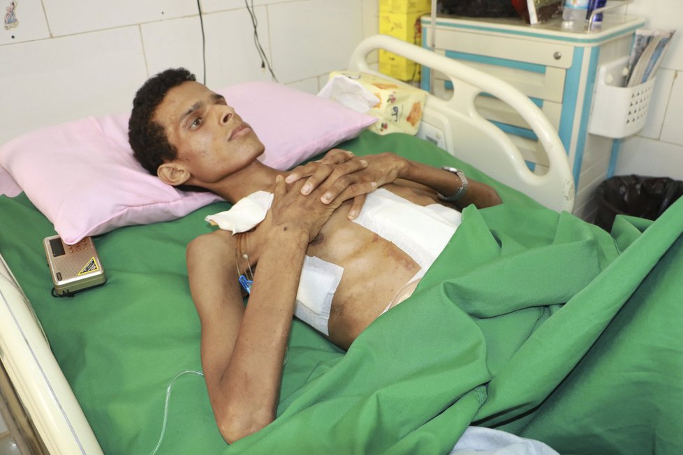 Nálety v Jemenu si vyžádaly nespočet obětí.