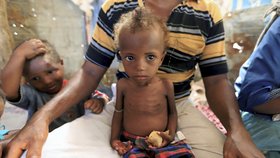 Největší obětí hladomoru v Jemenu jsou děti.