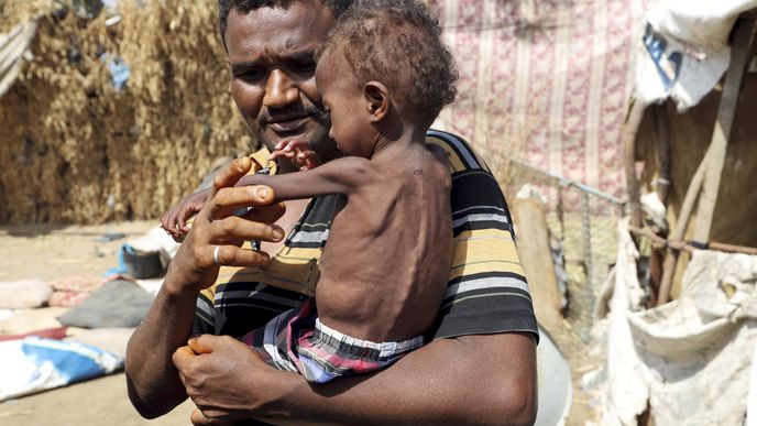 Chudé země se budou v nadcházejících letech potýkat s nejhoršími hladomory tohoto století.