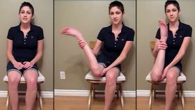 Dívka, která porazila rakovinu: Otáčí nohu o 180 stupňů!