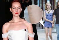 Tohle má být klenot Varů? Hvězda Jena Malone vypadá jako batůžkářka a je samá modřina!