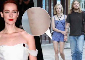 Poznali byste hollywoodskou hvězdu Jenu Malone? Ve Varech se prochází s přítelem a je samá modřina.