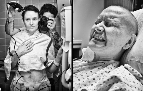 Čtyři měsíce po svatbě zemřela na rakovinu. Milující muž ji fotil do poslední chvíle
