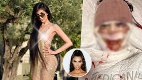 Žena dala přes 14 milionů, aby vypadala jako Kardashianka! Teď se nechává »přešít« zpátky