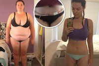 Australanka zhubla o 70 kilogramů a musela si nechat odstranit kůži z břicha!