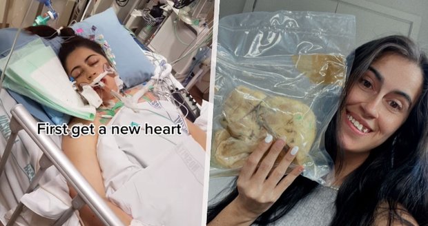 Žena se po transplantaci odmítla zbavit svého starého orgánu: Nemocné srdce má schované v pytlíku