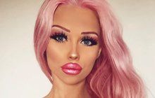 AMPUTACE? Česká Barbie Jiráčková (18) je vážně nemocná!