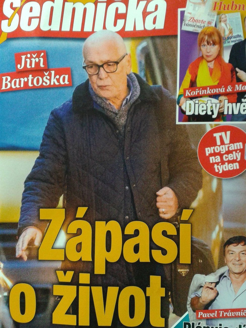 Bartoška bojuje s rakovinou a je úplně bez vlasů.