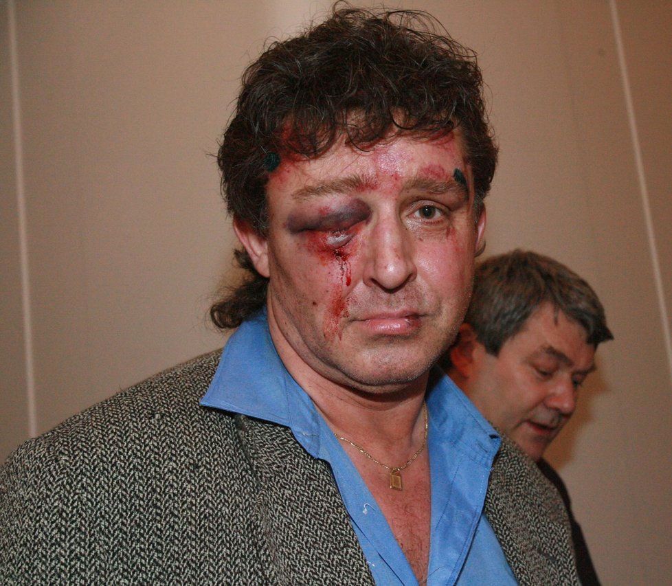 Poslance KSČM Jiřího Dolejše brutálně zbili násilníci v dubnu 2006. Tloukli ho pěstmi a nadávali mu do komunistických sviní.