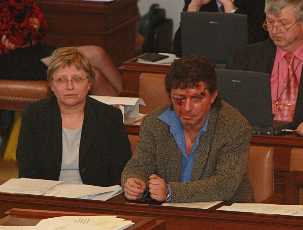 Poslance KSČM Jiřího Dolejše brutálně zbili násilníci v dubnu 2006. Tloukli ho pěstmi a nadávali mu o komunistických sviní.
