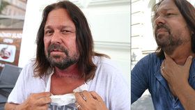Jiří Pomeje bojující s rakovinou hrtanu zazdil 53. narozeniny: Ještě 5 dní hladovky!