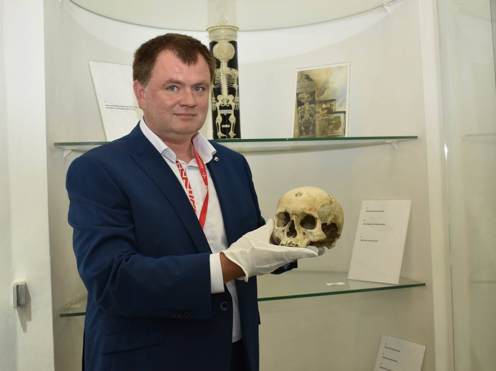 Kurátor výstavy Aleš Česal s lebkou se zhojeným bodným zraněním na čelní kosti z Nepraktovy antropologické sbírky.