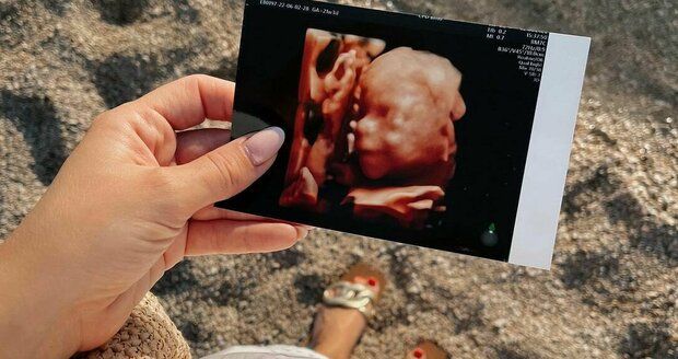 Jitka Boho se podělila s fanynkami o 3D snímek miminka