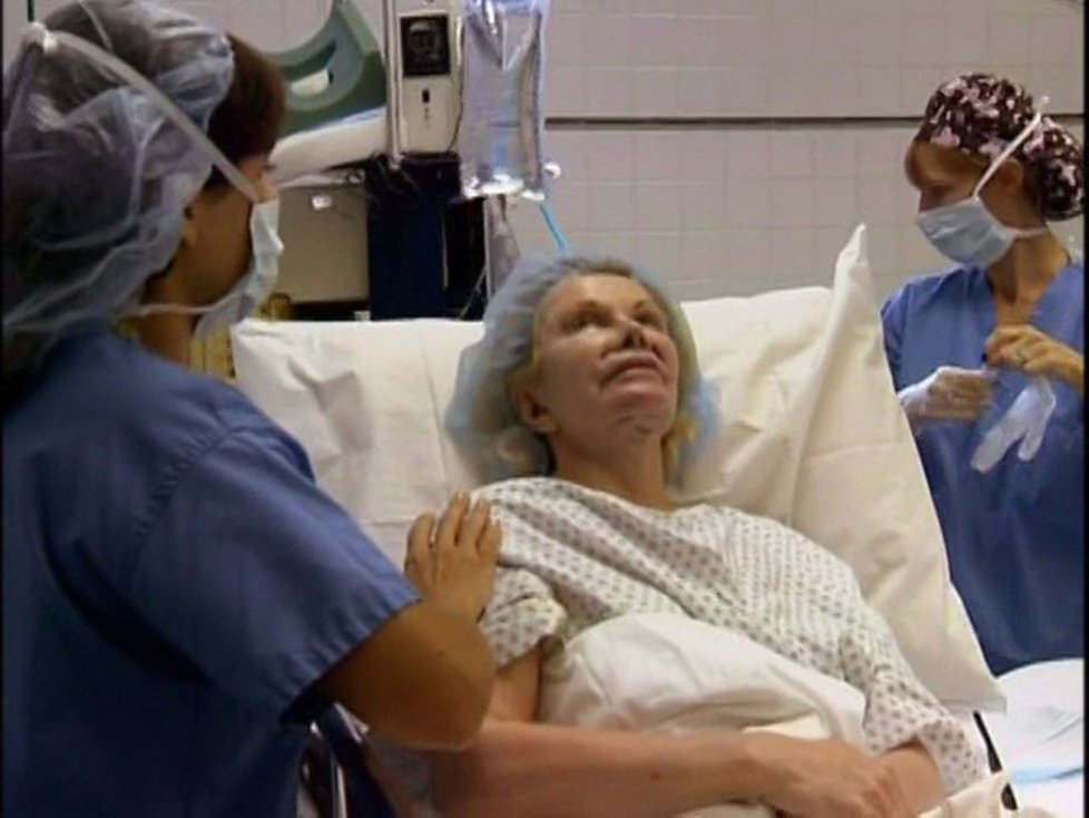 Joan Rivers těsně před poslední plastickou operací.