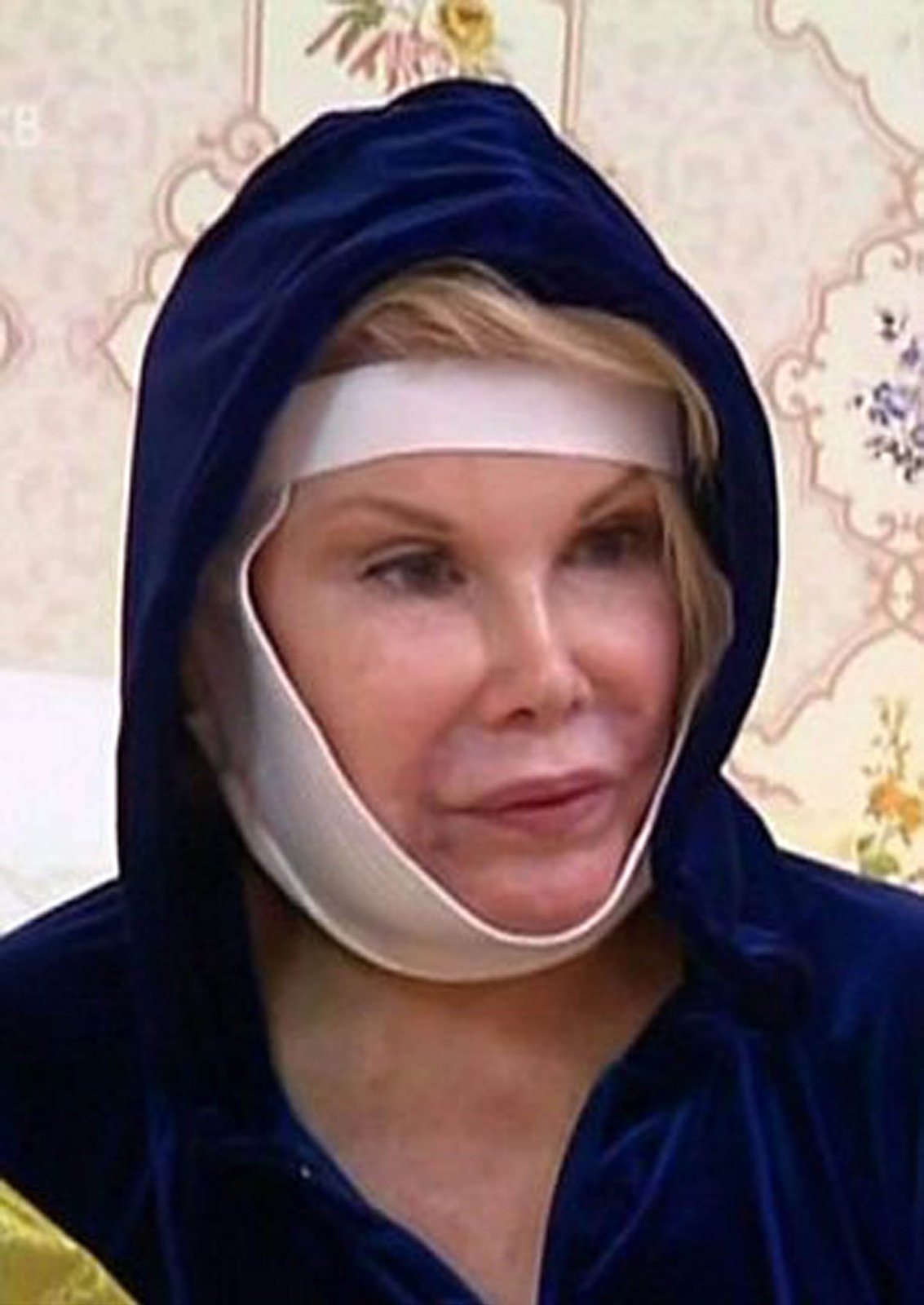 Joan Rivers při a po posledním zákroku, u kterého asistovala televize.