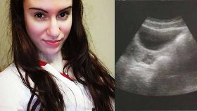 Joanna Giannouli se narodila bez vaginy.