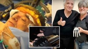 Legendární pianista může po 20 letech zase hrát: Dostal bionické rukavice!