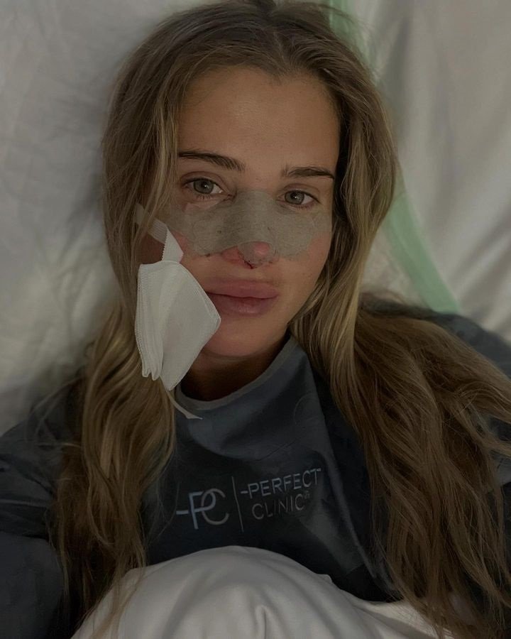 Po operaci musela Johanka nosit obvaz a měla modřiny po obličeji.