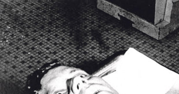 Snímek z Kennedyho pitvy