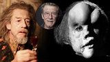 Zemřel „Sloní muž“, herec John Hurt: Zabila ho rakovina slinivky