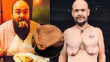 Johnny se 25 let přejídal, teď zhubl 100 kilo: Prosí lidi, ať mu pomůžou zbavit se nadbytečné kůže