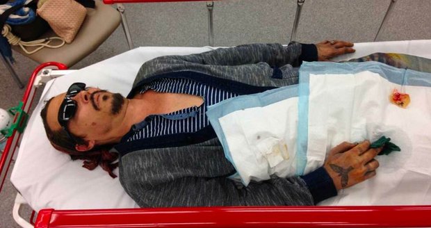 Březen 2015. Johnny Depp v nemocnici s uříznutým prstem.