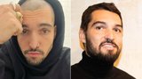 Jordan Haj zarostlý jako Rumcajs: Po 15 letech boje s alopecií mu zabrala léčba
