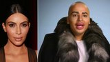 Muž chce vypadat jako Kim Kardashian, ale další plastiky mu zamítli: Nemůže hýbat obličejem