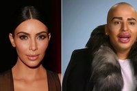 Muž chce vypadat jako Kim Kardashian, ale další plastiky mu zamítli: Nemůže hýbat obličejem