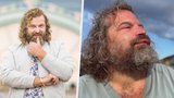 Opuchlý cukrář Maršálek: Za obří ret schytal obří hejty