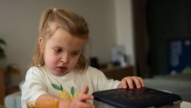 To vše jen díky velmi nákladným a náročným rehabilitacím