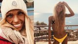 Influencerka (†24) na dovolené podlehla anorexii: Z posledních fotek mrazí!