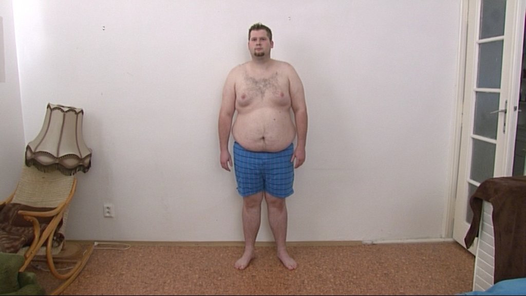 Marek chce zhubnout bez lékařského zákroku