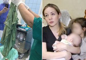 Doktoři v mladé matce zapomněli operační roušku.