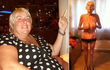 Julie zhubla ze 130 na 38 kg: Porazila obezitu, teď umírá na podvyživení!