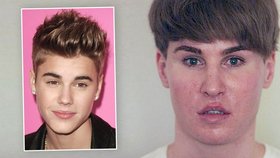 Němec Tobias Strebel, který se za pomoci plastických operací snažil vypadat jako Justin Bieber, zemřel.
