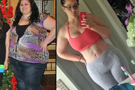 Lékař jí odmítl zmenšit žaludek. Žena sama zhubla za rok o sto kilogramů