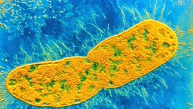 Na Kanárských ostrovech se nakazilo 13 lidí bakterií Klebsiella pneumoniae, úřady volají na poplach.