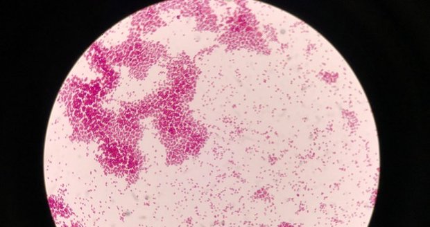 Původce kapavky, bakterie Neisseria gonorrhoeae, pod mikroskopem.
