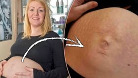 Děsivé! Těhotné ženě vykukuje dítě z břicha