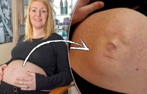 Děsivé! Těhotné ženě vykukuje dítě z břicha