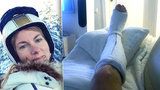Moderátorka Mráčková skončila v nemocnici: Se zlomenou nohou ještě lyžovala!