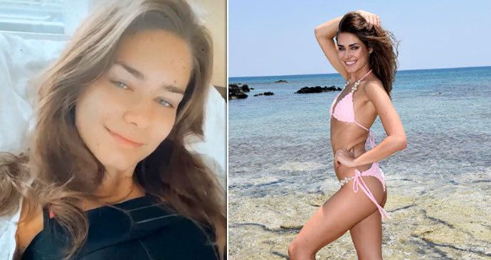 Karolína Kokešová, která získala korunku Miss Global: Po vítězství šla na plastiku! Má nové trojky